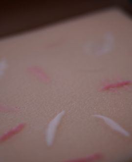 Модель шкіри з рубцями для навчання та відпрацювання технік